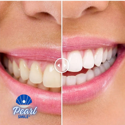 PearlSmile® | Lápiz blanqueador dental